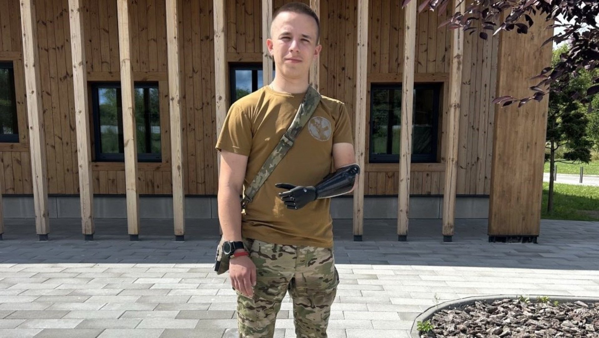 20-річному військовому з Житомира, який втратив руку під час Курської операції, встановили біонічний протез