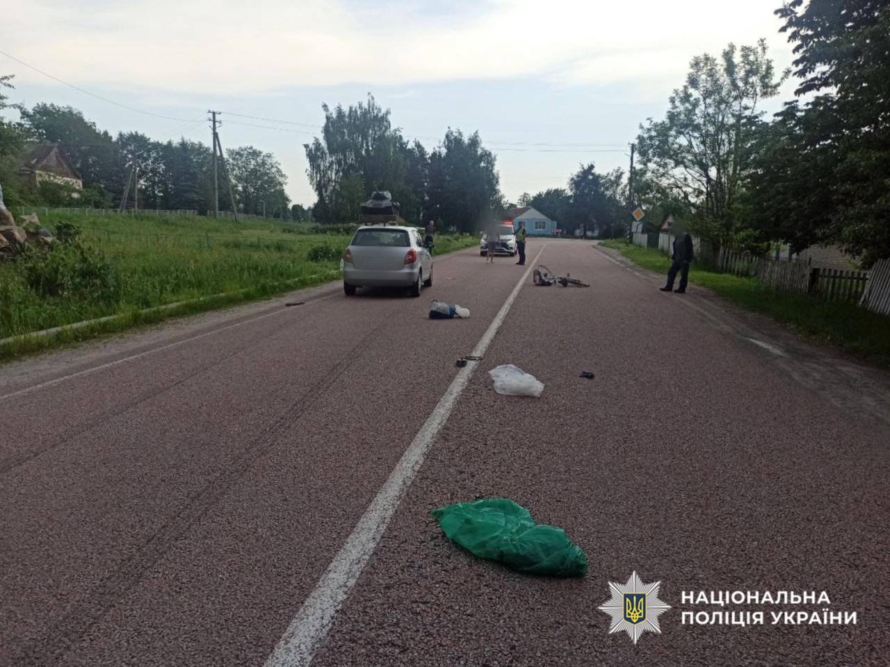 На Житомирщині на сільській вулиці водій наїхав на пенсіонерку-велосипедистку: жінка в реанімації